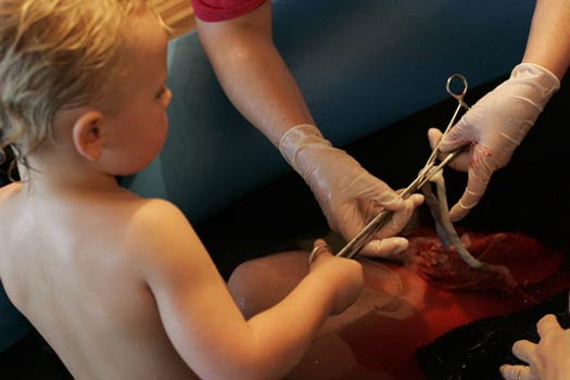 Aus der Praxis: W&auml;hrend der Geburt